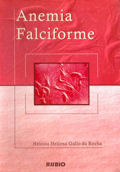 Picture of ANEMIA FALCIFORME