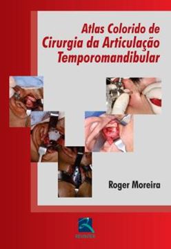 Imagem de ATLAS COLORIDO DE CIRURGIA DA ARTICULACAO TEMPOROMANDIBULAR