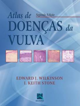 Imagem de ATLAS DE DOENCAS DA VULVA - 2ª ED