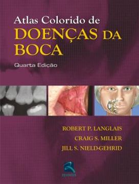 Imagem de ATLAS COLORIDO DE DOENCAS DA BOCA - 4ª ED