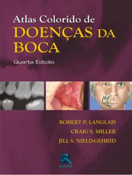 Picture of ATLAS COLORIDO DE DOENCAS DA BOCA - 4ª ED