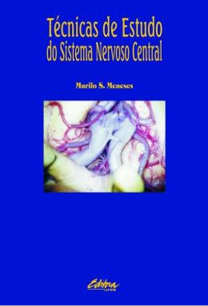 Picture of TECNICAS DE ESTUDO DO SISTEMA NERVOSO CENTRAL
