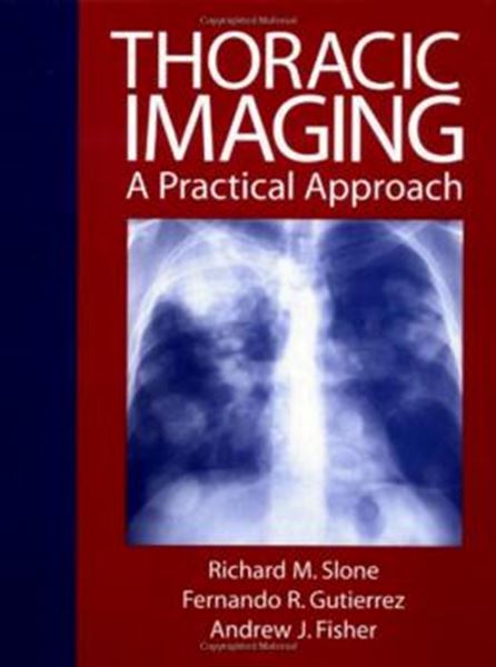 Picture of REVIEW OF THORAIC IMAGING AND CHEST DISEASE