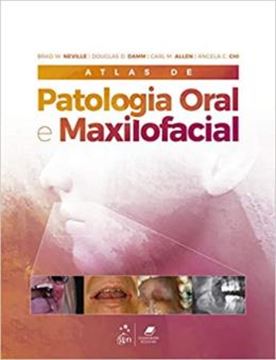Imagem de ATLAS DE PATOLOGIA ORAL E MAXILOFACIAL