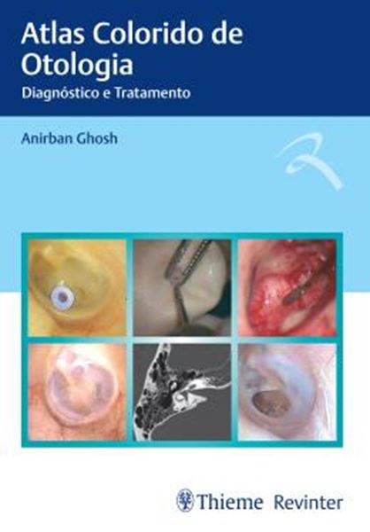 Picture of ATLAS COLORIDO DE OTOLOGIA - DIAGNOSTICO E TRATAMENTO